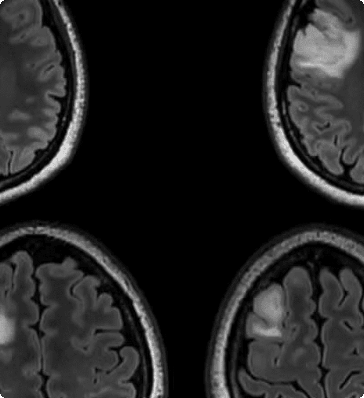 NeuroCarta Brain Scans